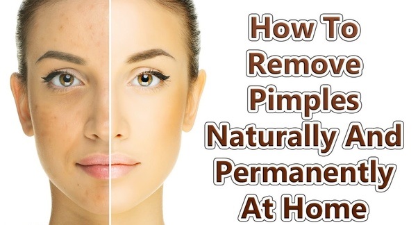 Best Ways To Remove Pimples Naturally