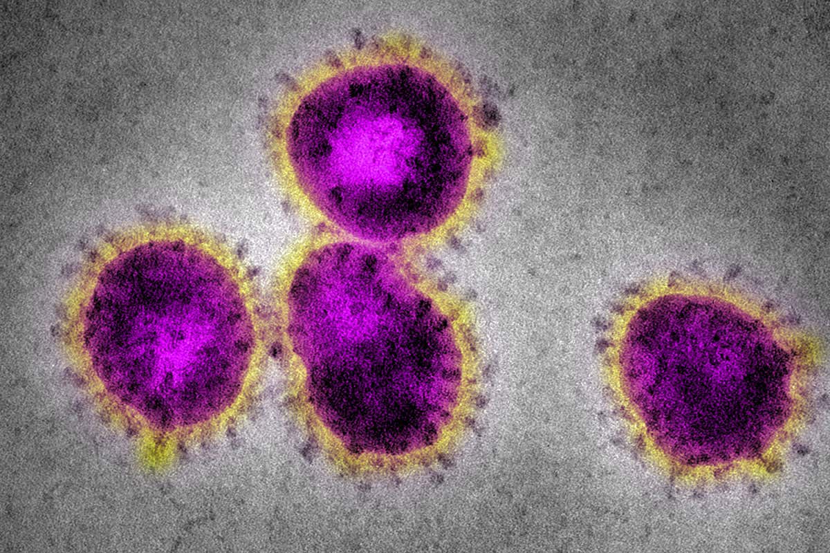 What does Coronavirus look like