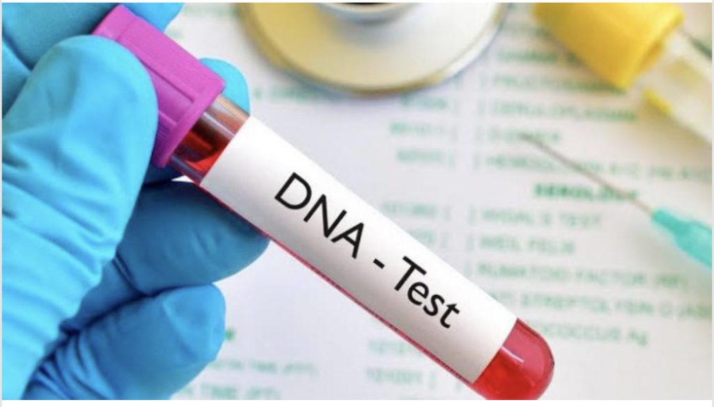 Cost And Procedures To Do DNA Test In Nigeria